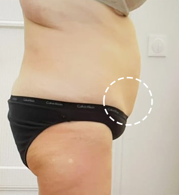 After treatment