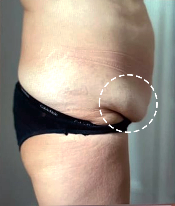 Before treatment
