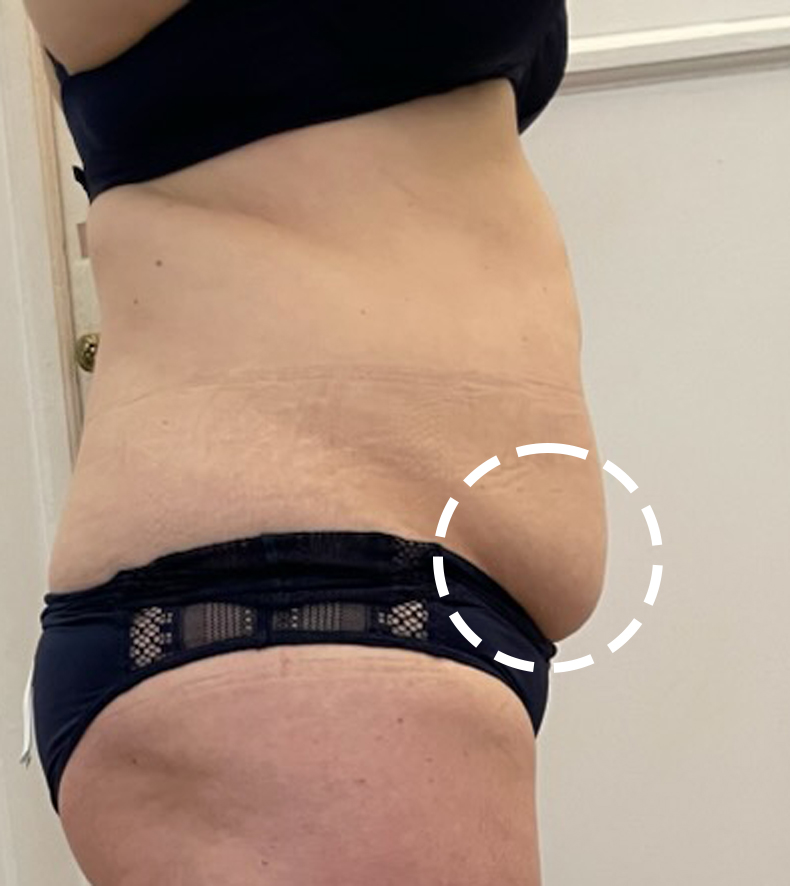 Before treatment