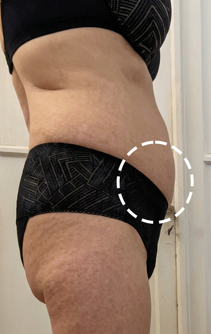 After treatment