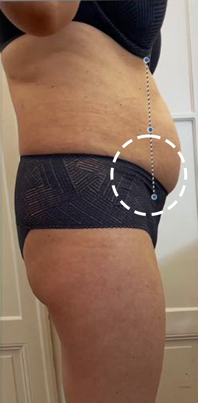 Before treatment