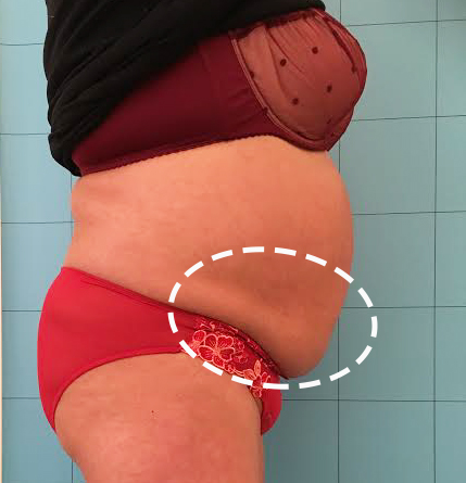 Before treatment