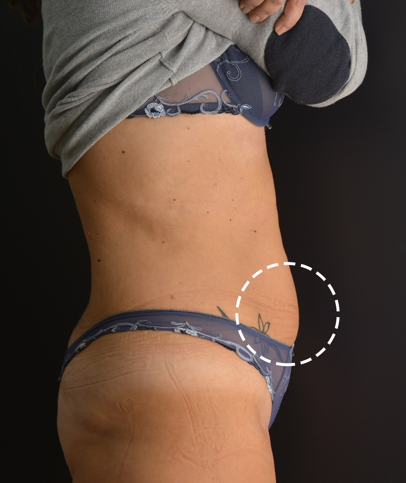 Clinical study after treatment