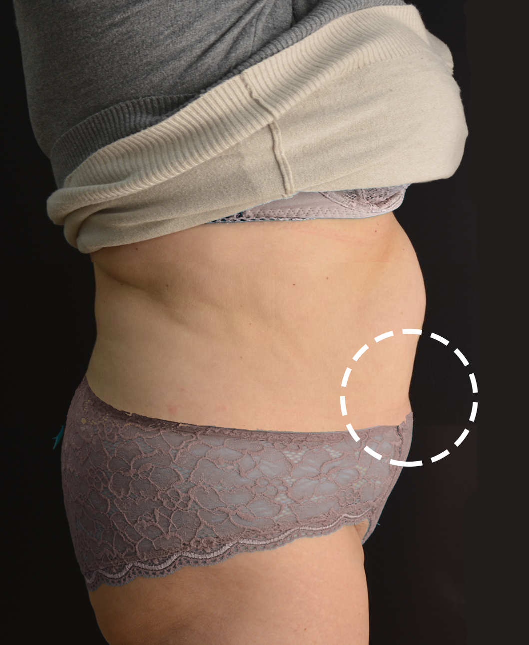 Clinical study after treatment