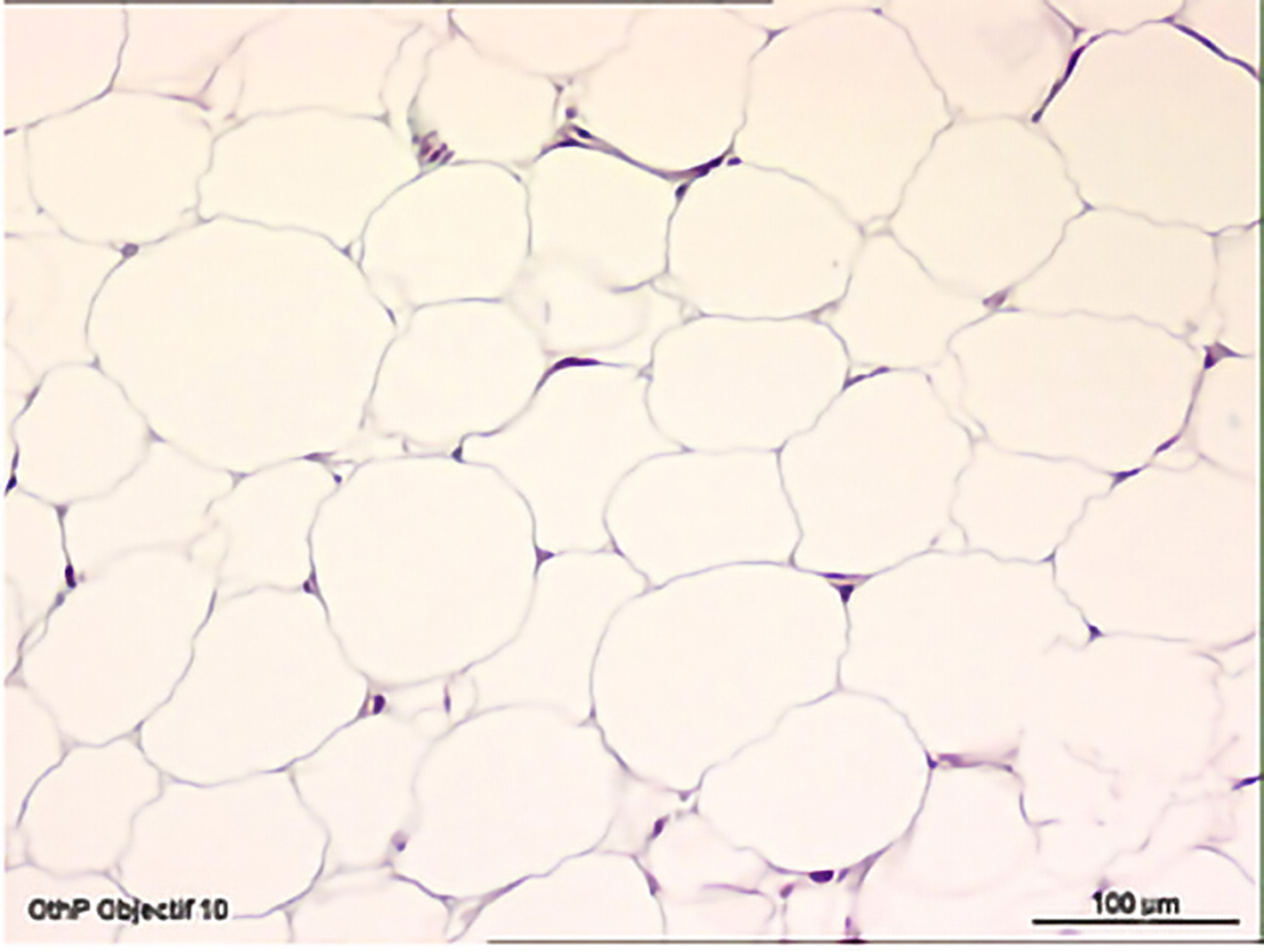 Human explant — control specimen