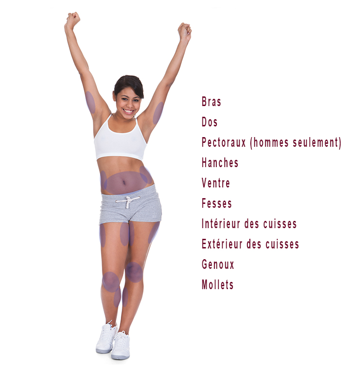 Zones traitables Slimiser